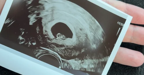 Prosjektbilde for Ønsket om å bli mamma♥️