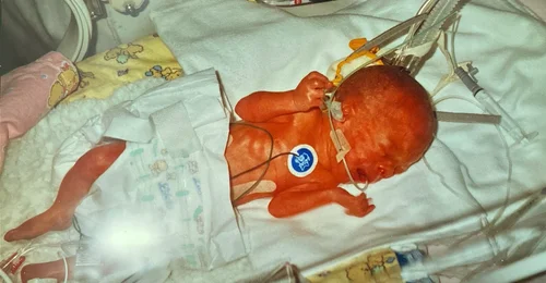 Prosjektbilde for Gi premature på nyfødt intensiven i Vestfold en prematurpakke fra SMÅ SMIL