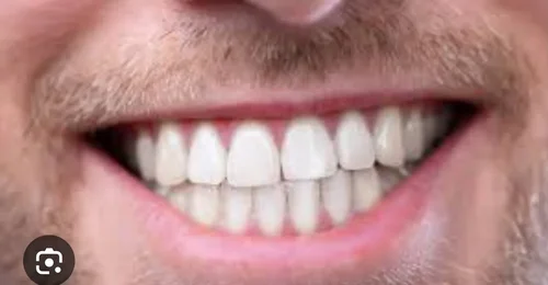 Prosjektbilde for Et nytt smil, et nytt liv